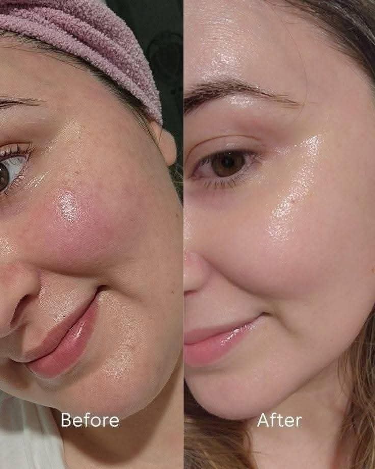 صابونة كوجي سان الفلبينية